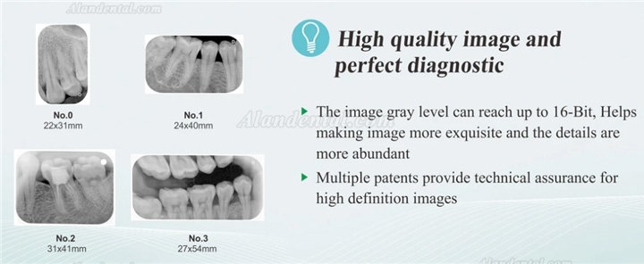 TYRIS CR-100 Dental Digital Intraoral Imaging Plate Scanner Dental Scanning Processing System